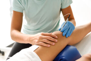 Acupuncture Therapy Edmonton | In Step Physical Therapy