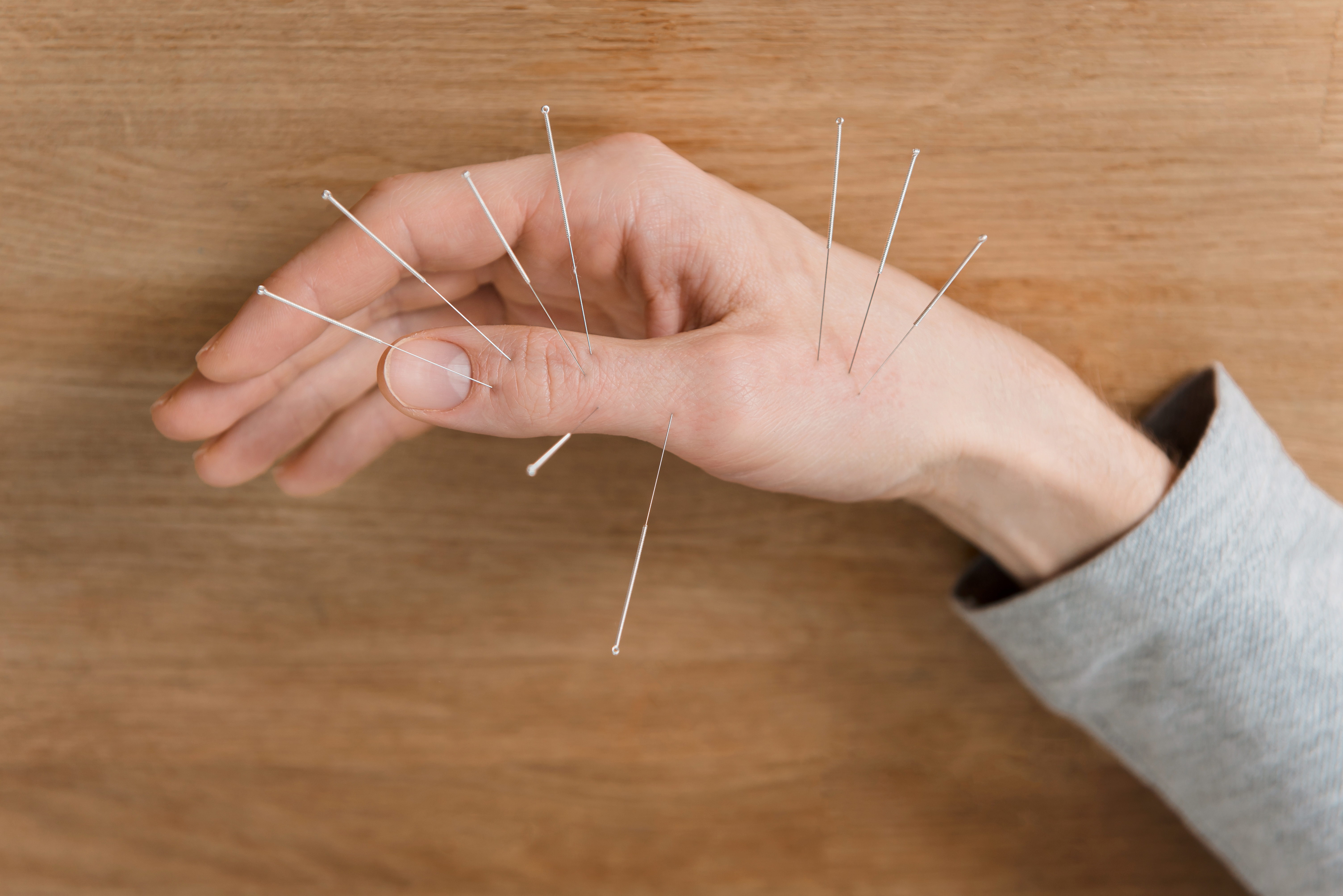 Read more about the article Acupuncturist Edmonton